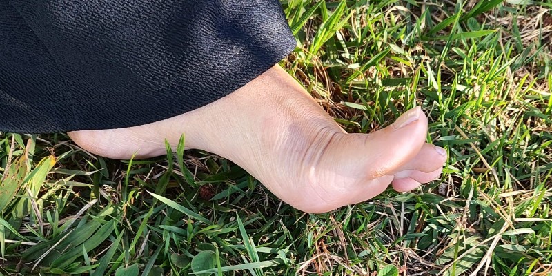 Fascite plantar: o que é, sintomas, causas e tratamento