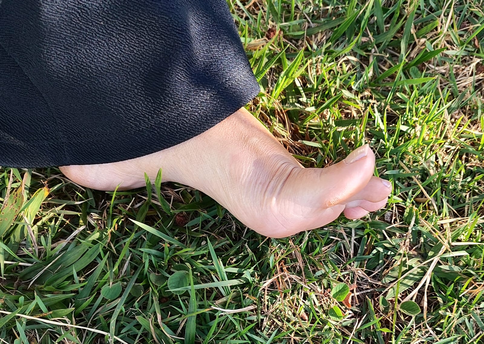 Fascite plantar: o que é, sintomas, causas e tratamento