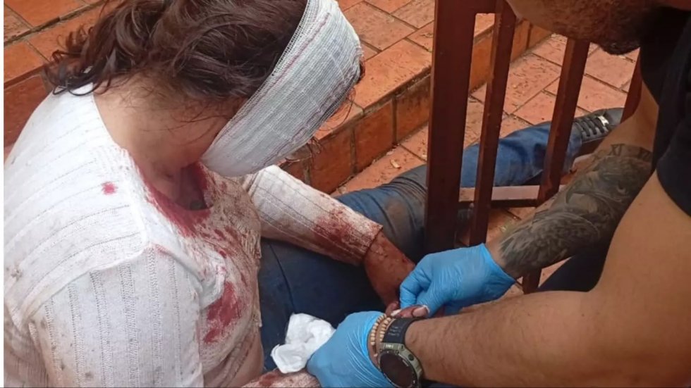 Mulher é atacada por pitbull ao defender cadela e é salva por sargento da PM