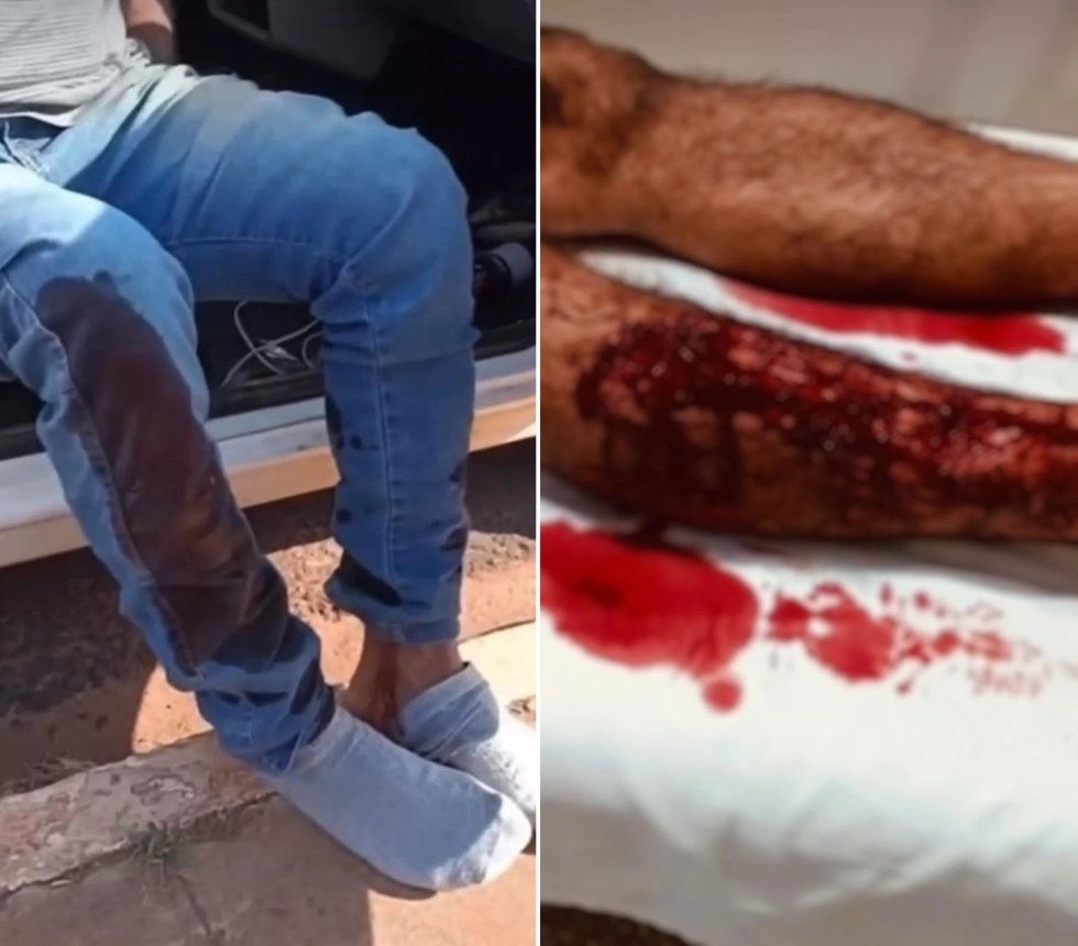 NOVA ANDRADINA: Homem é atacado por dois cães no Jardim Imperial