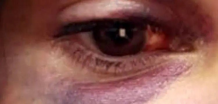 Com 5 casos de feminicídio em um mês, julho se torna o mais violento e MS tem 18 mulheres mortas 