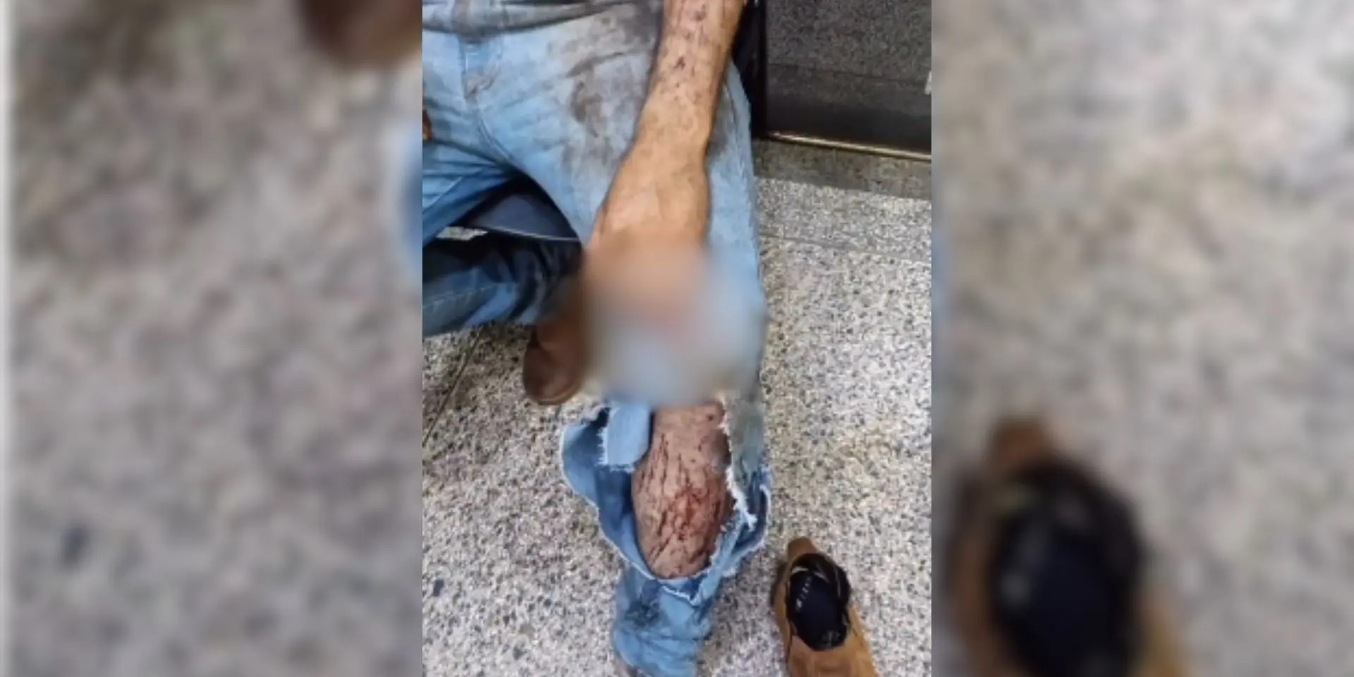 Morador é atacado por onça enquanto trabalhava em colheita em Ponta Porã